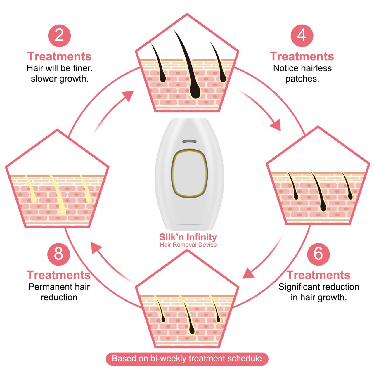 Home Use Laser Hair Removal Device-2